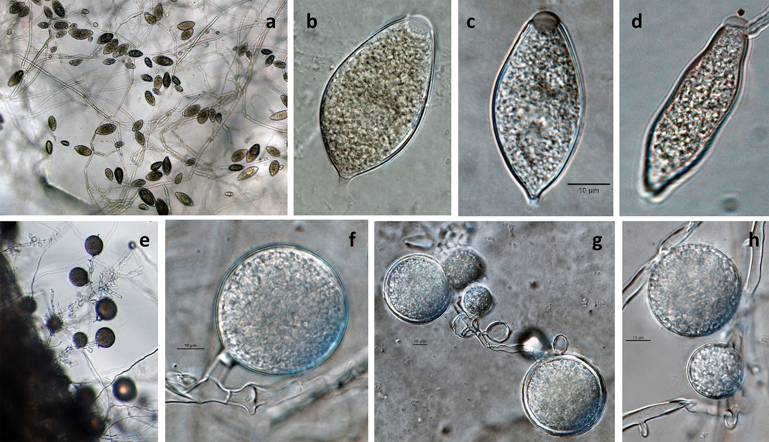   Phytophthora ramorum nbsp;(ex-type CPHST BL 55G) asexual phase (andash;h): (a) sporangia in sporangiophores, (bndash;d) semipapillated sporangia with short pedicels; (endash;h) chlamydospores, (f) terminal, (g, h) intercalary and lateral; photos by Gloria Abad, USDA-APHIS-PPQ. 
